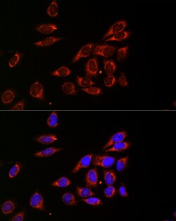 Invitrogen CDA Polyclonal Antibody 100 &mu;L; Unconjugated:Antibodies,