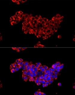 Invitrogen CDA Polyclonal Antibody 100 &mu;L; Unconjugated:Antibodies,