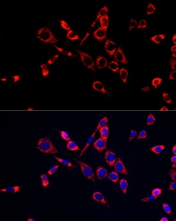 Invitrogen CDA Polyclonal Antibody 100 &mu;L; Unconjugated:Antibodies,