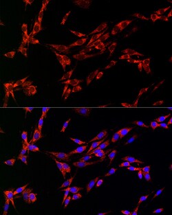 Invitrogen CDA Polyclonal Antibody 100 &mu;L; Unconjugated:Antibodies,