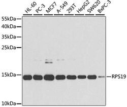 Invitrogen RPS19 Polyclonal Antibody 100 &mu;L; Unconjugated:Antibodies,