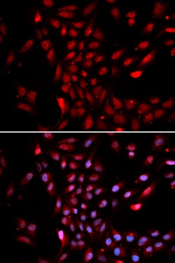Invitrogen KPNA4 Polyclonal Antibody 100 &mu;L; Unconjugated:Antibodies,