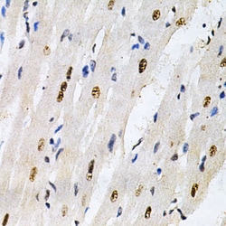 Invitrogen KPNA4 Polyclonal Antibody 100 &mu;L; Unconjugated:Antibodies,