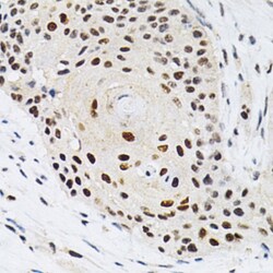 Invitrogen KPNA4 Polyclonal Antibody 100 &mu;L; Unconjugated:Antibodies,