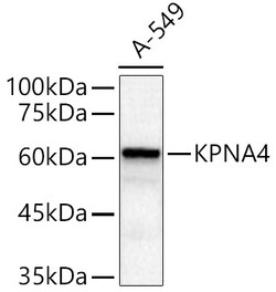 Invitrogen KPNA4 Polyclonal Antibody 100 &mu;L; Unconjugated:Antibodies,