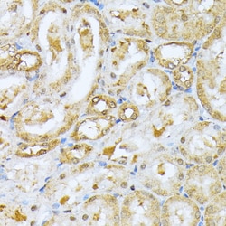 Invitrogen RPS27A Polyclonal Antibody 100 &mu;L | Buy Online | Invitrogen&trade; | Fisher Scientific