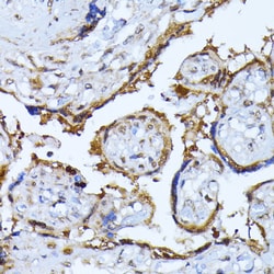 Invitrogen RPS27A Polyclonal Antibody 100 &mu;L | Buy Online | Invitrogen&trade; | Fisher Scientific