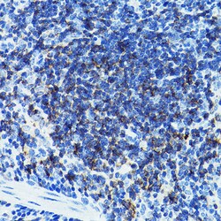 Invitrogen CD79b Polyclonal Antibody 100 &mu;L; Unconjugated:Antibodies,