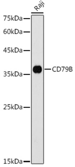 Invitrogen CD79b Polyclonal Antibody 100 &mu;L; Unconjugated:Antibodies,