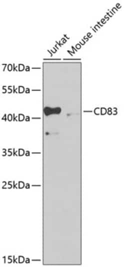 Invitrogen CD83 Polyclonal Antibody 100 &mu;L; Unconjugated:Antibodies,