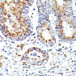 Invitrogen IL13RA2 Polyclonal Antibody 100 &mu;L; Unconjugated:Antibodies,