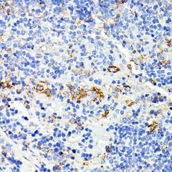 Invitrogen IL13RA2 Polyclonal Antibody 100 &mu;L; Unconjugated:Antibodies,