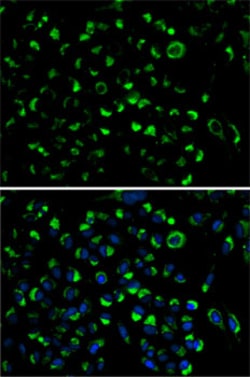 Invitrogen Adenylate Kinase 4 Polyclonal Antibody 100 &mu;L; Unconjugated:Antibodies,