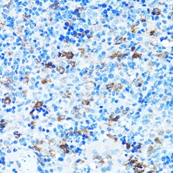 Invitrogen FGFR2 Polyclonal Antibody 100 &mu;L | Buy Online | Invitrogen&trade; | Fisher Scientific