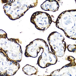 Invitrogen FGFR2 Polyclonal Antibody 100 &mu;L | Buy Online | Invitrogen&trade; | Fisher Scientific