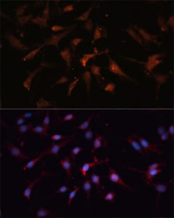 GSK3B Polyclonal Antibody:Antibodies, Polyclonal