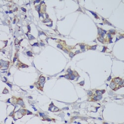 GSK3B Polyclonal Antibody:Antibodies, Polyclonal