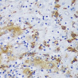 GSK3B Polyclonal Antibody:Antibodies, Polyclonal