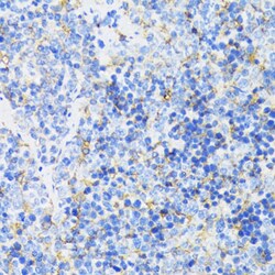 GSK3B Polyclonal Antibody:Antibodies, Polyclonal