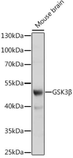 GSK3B Polyclonal Antibody:Antibodies, Polyclonal