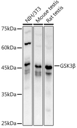 GSK3B Polyclonal Antibody:Antibodies, Polyclonal