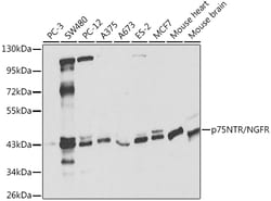 Invitrogen NGF Receptor Polyclonal Antibody 100 &mu;L; Unconjugated:Antibodies,