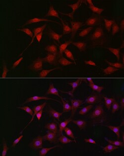 Invitrogen LKB1 Polyclonal Antibody 100 &mu;L; Unconjugated:Antibodies,