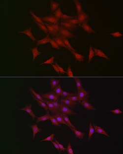 Invitrogen LKB1 Polyclonal Antibody 100 &mu;L; Unconjugated:Antibodies,