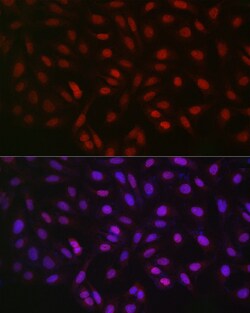 Invitrogen LKB1 Polyclonal Antibody 100 &mu;L; Unconjugated:Antibodies,