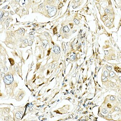 Invitrogen LKB1 Polyclonal Antibody 100 &mu;L; Unconjugated:Antibodies,