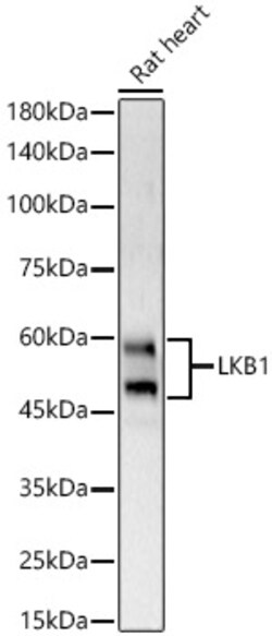 Invitrogen LKB1 Polyclonal Antibody 100 &mu;L; Unconjugated:Antibodies,
