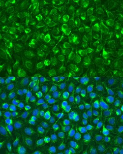Invitrogen Syk Polyclonal Antibody 100 &mu;L | Buy Online | Invitrogen&trade; | Fisher Scientific