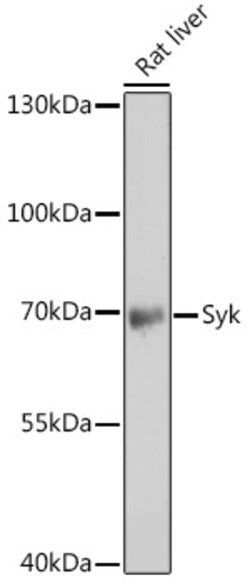 Invitrogen Syk Polyclonal Antibody 100 &mu;L | Buy Online | Invitrogen&trade; | Fisher Scientific