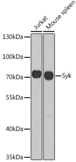 Invitrogen Syk Polyclonal Antibody 100 &mu;L | Buy Online | Invitrogen&trade; | Fisher Scientific