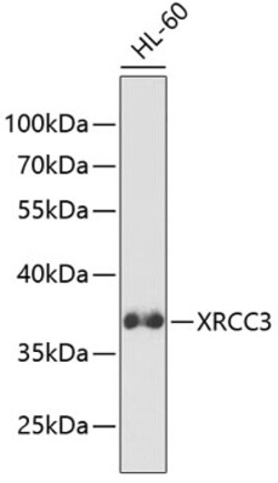 XRCC3 Polyclonal Antibody:Antibodies, Polyclonal