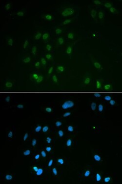 Invitrogen CHK2 Polyclonal Antibody 100 &mu;L; Unconjugated:Antibodies,