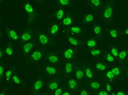 Invitrogen CHK2 Polyclonal Antibody 100 &mu;L; Unconjugated:Antibodies,
