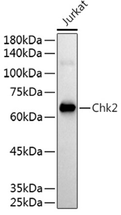 Invitrogen CHK2 Polyclonal Antibody 100 &mu;L; Unconjugated:Antibodies,