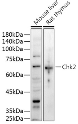 Invitrogen CHK2 Polyclonal Antibody 100 &mu;L; Unconjugated:Antibodies,