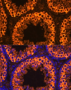 PIWIL1 Polyclonal Antibody:Antibodies, Polyclonal