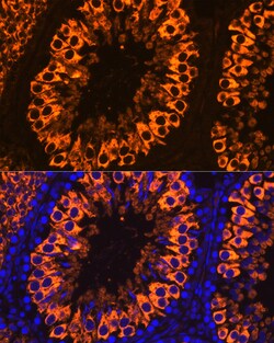 PIWIL1 Polyclonal Antibody:Antibodies, Polyclonal
