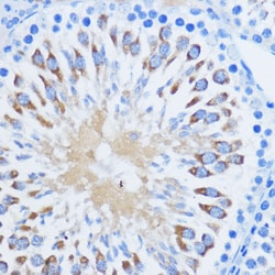 PIWIL1 Polyclonal Antibody:Antibodies, Polyclonal