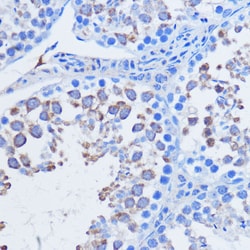 PIWIL1 Polyclonal Antibody:Antibodies, Polyclonal