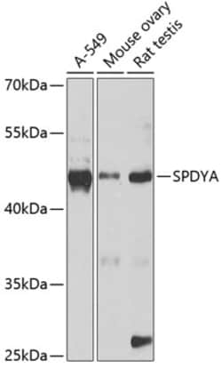 Invitrogen SPDYA Polyclonal Antibody 100 &mu;L; Unconjugated:Antibodies,