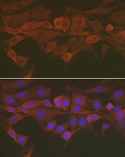 Invitrogen Caspase 3 Polyclonal Antibody 100 &mu;L; Unconjugated:Antibodies,