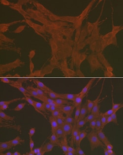 Invitrogen Caspase 3 Polyclonal Antibody 100 &mu;L; Unconjugated:Antibodies,