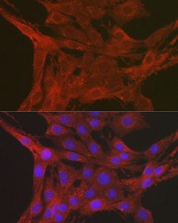 Invitrogen Caspase 3 Polyclonal Antibody 100 &mu;L; Unconjugated:Antibodies,