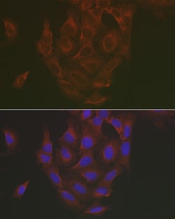 Invitrogen Caspase 3 Polyclonal Antibody 100 &mu;L; Unconjugated:Antibodies,