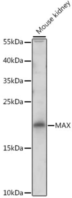 Invitrogen MAX Polyclonal Antibody 100 &mu;L | Buy Online | Invitrogen&trade; | Fisher Scientific