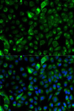 Invitrogen Cytokeratin 17 Polyclonal Antibody 100 &mu;L; Unconjugated:Antibodies,